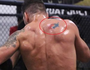 Chris Weidman’s 3 Tattoos & Their Meanings – Body Art Guru