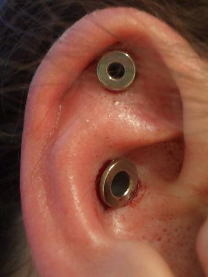 dermal punch ear piercing