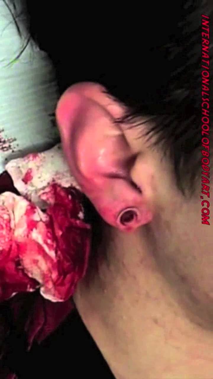 dermal punch ear piercing