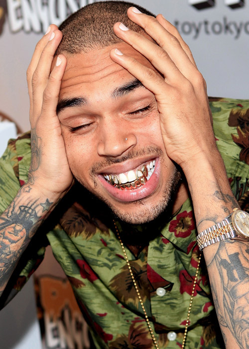 Chris Brown Gold Teeth Permanent