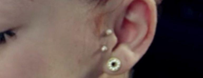 18 Celebrities With Surface Piercing