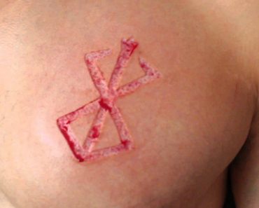 All You Need to Know About Chemical Scarification