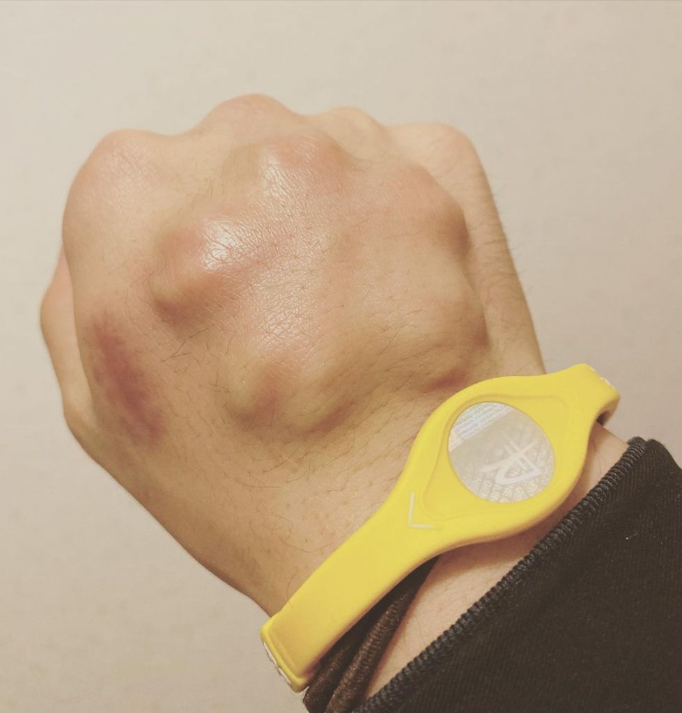 What is Subdermal Implant? Body Art Guru