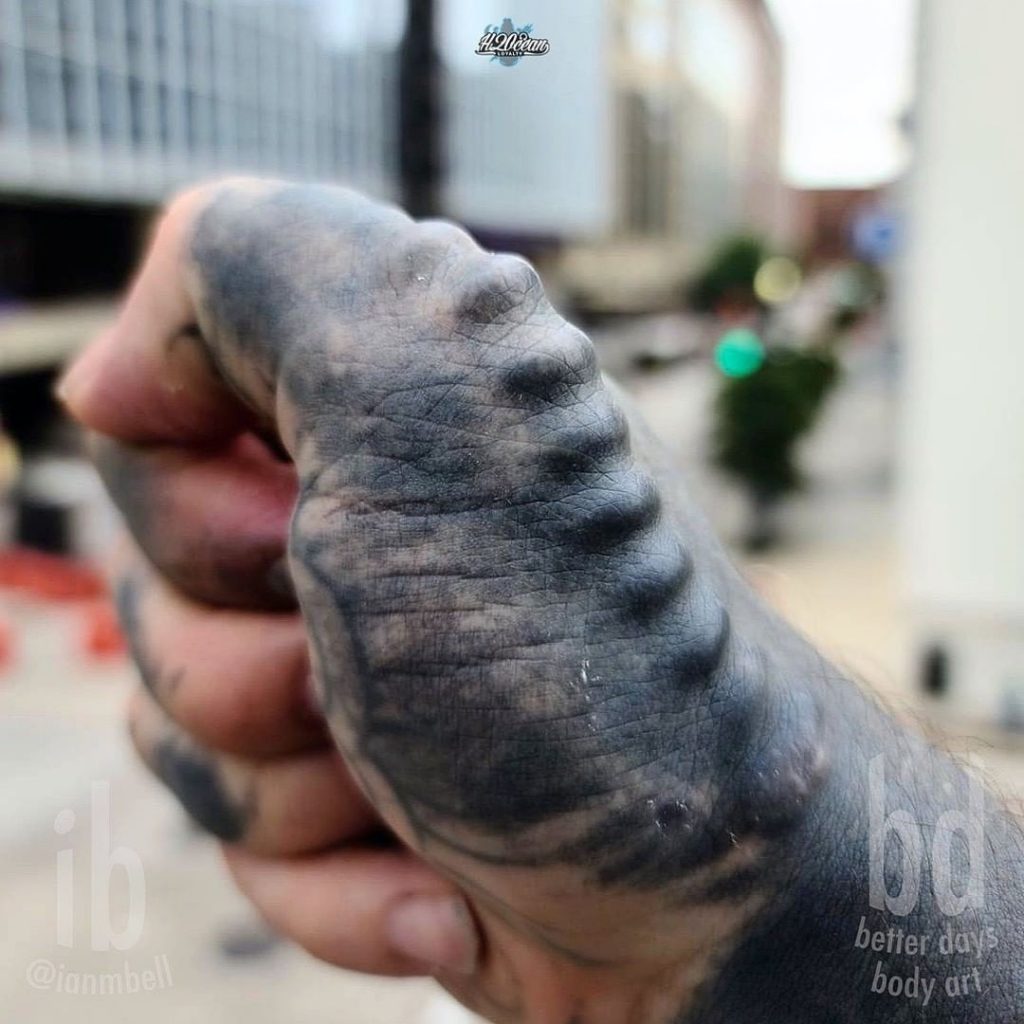 What is Subdermal Implant? Body Art Guru