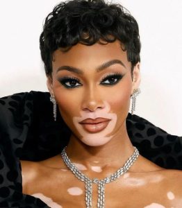 Winnie Harlow's Tattoo and its Meaning - Body Art Guru